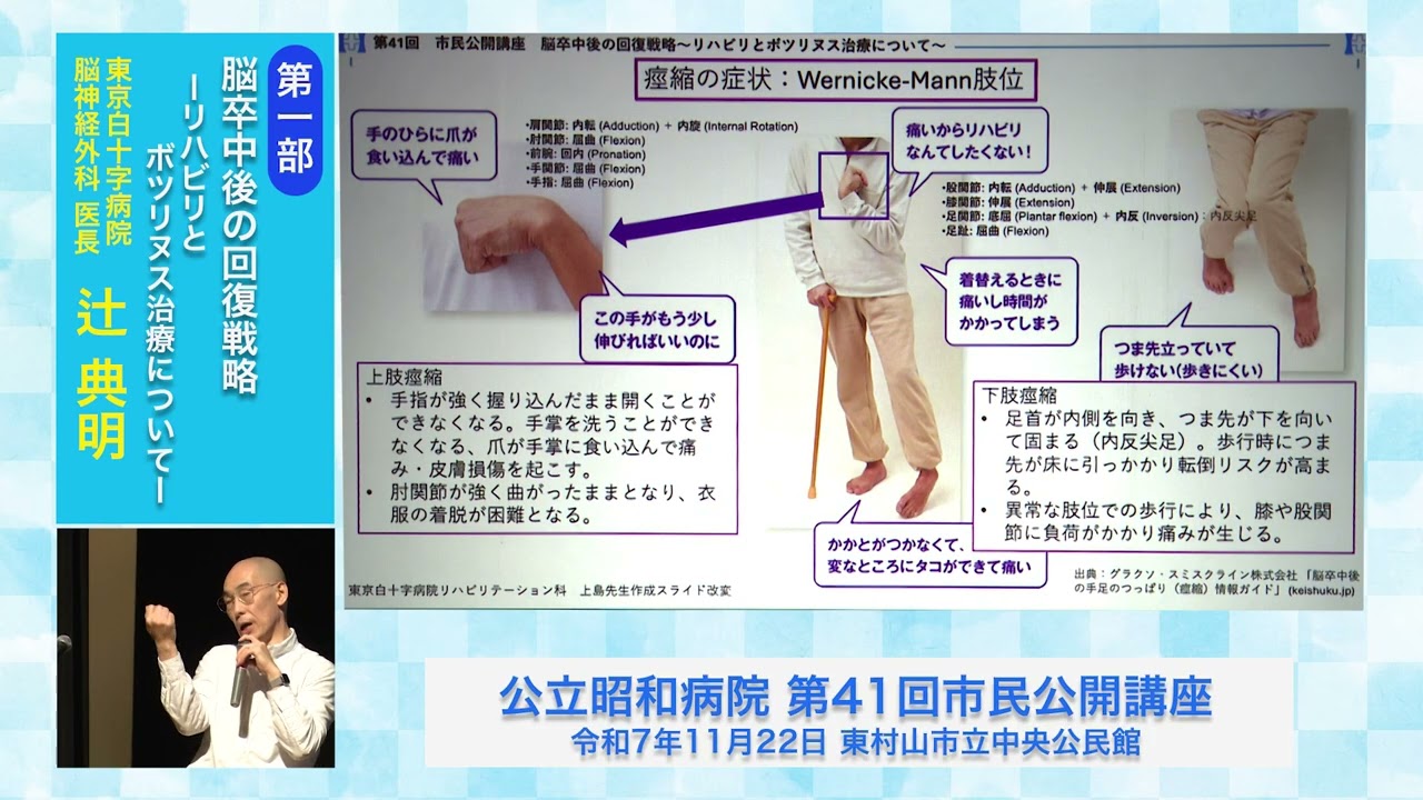 脳卒中後の回復戦略～リハビリとボツリヌス治療について～　　　　　　　東京白十字病院　脳神経外科　医長　辻　典明　先生