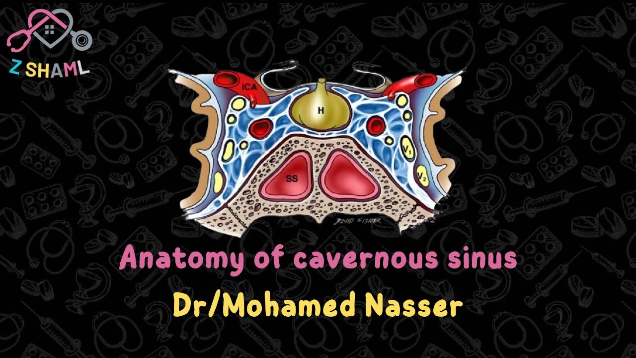 2- Anatomy of Cavernous sinus