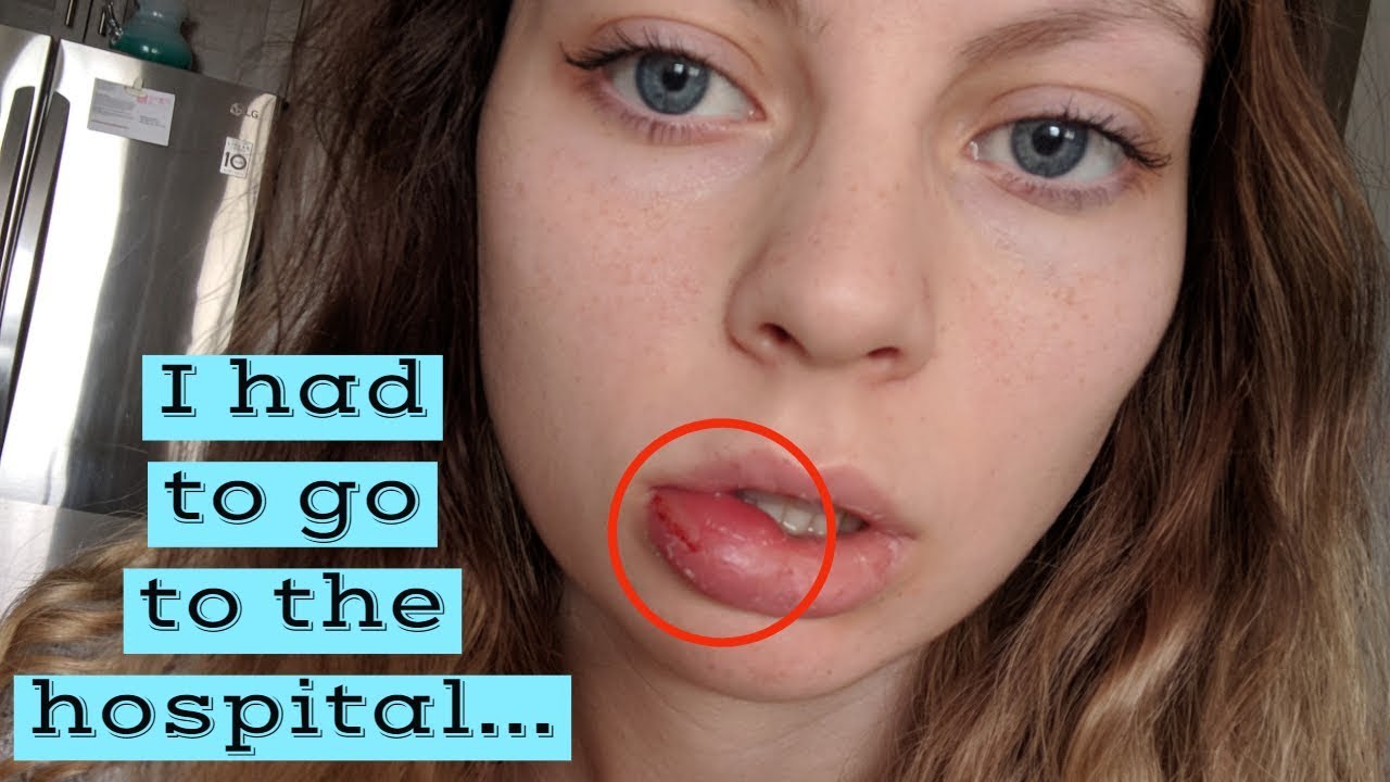 Storytime: LIP PIERCING HORROR STORY