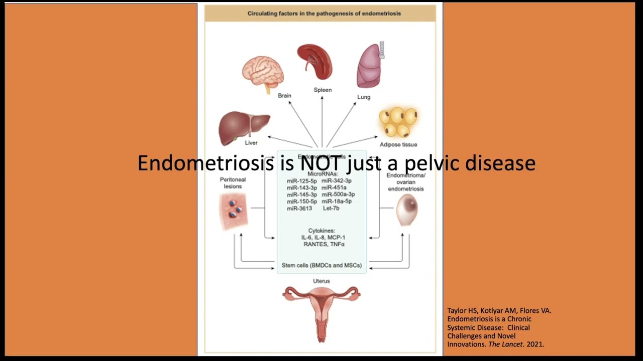 Endometriosis: What it is and how we can help