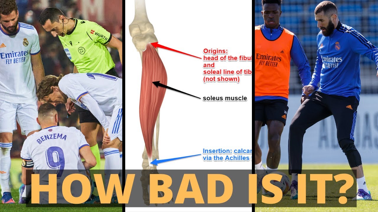 Expert Explains Karim Benzema Injury (Soleus) | 4 Things To Know