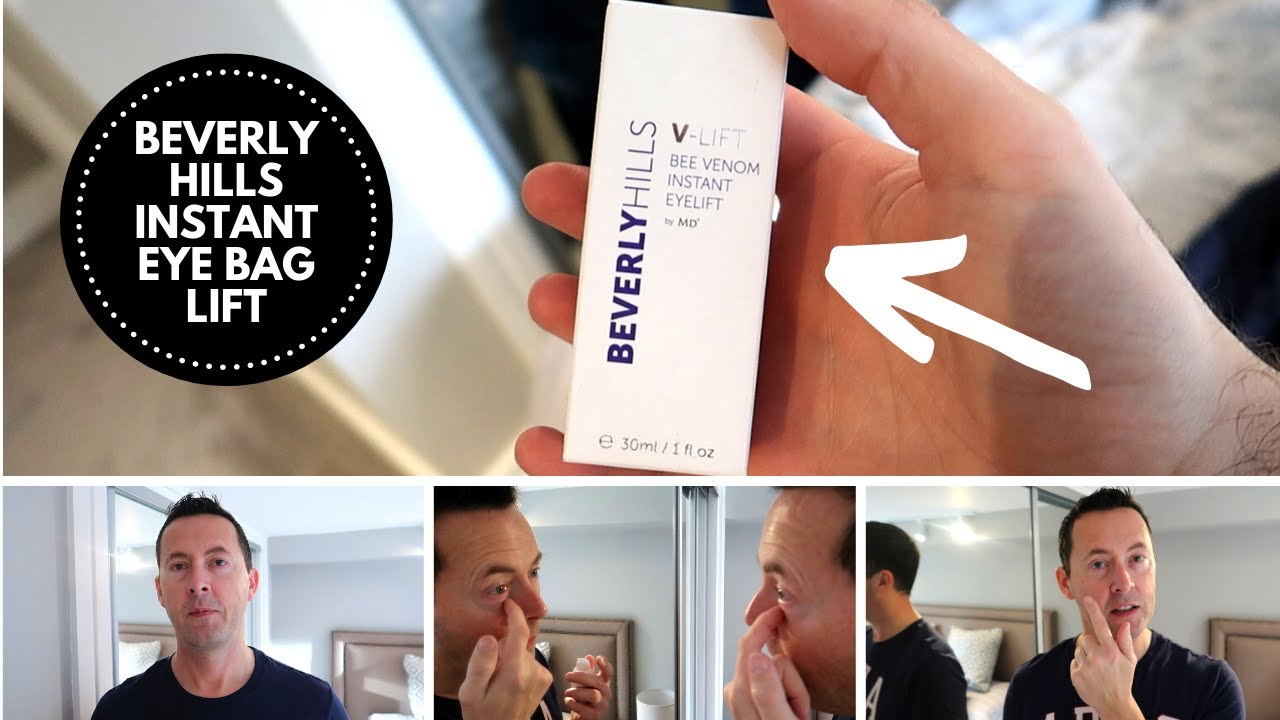 NICK REMOVES HIS DARK CIRCLE EYE BAGS | BEVERLY HILLS INSTANT EYE LIFT | THE LODGE GUYS VLOG