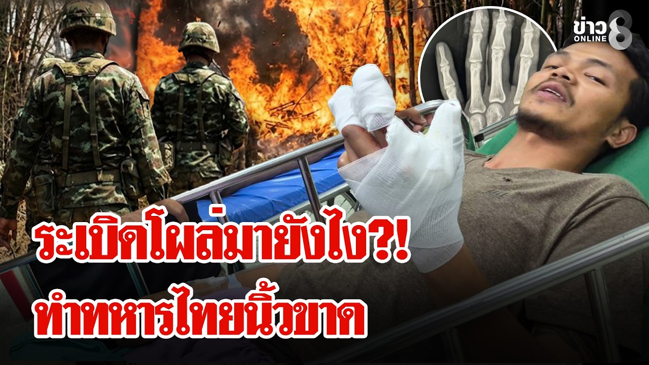 ระทึก! ทหารไทยถูกระเบิดนิ้วขาด 