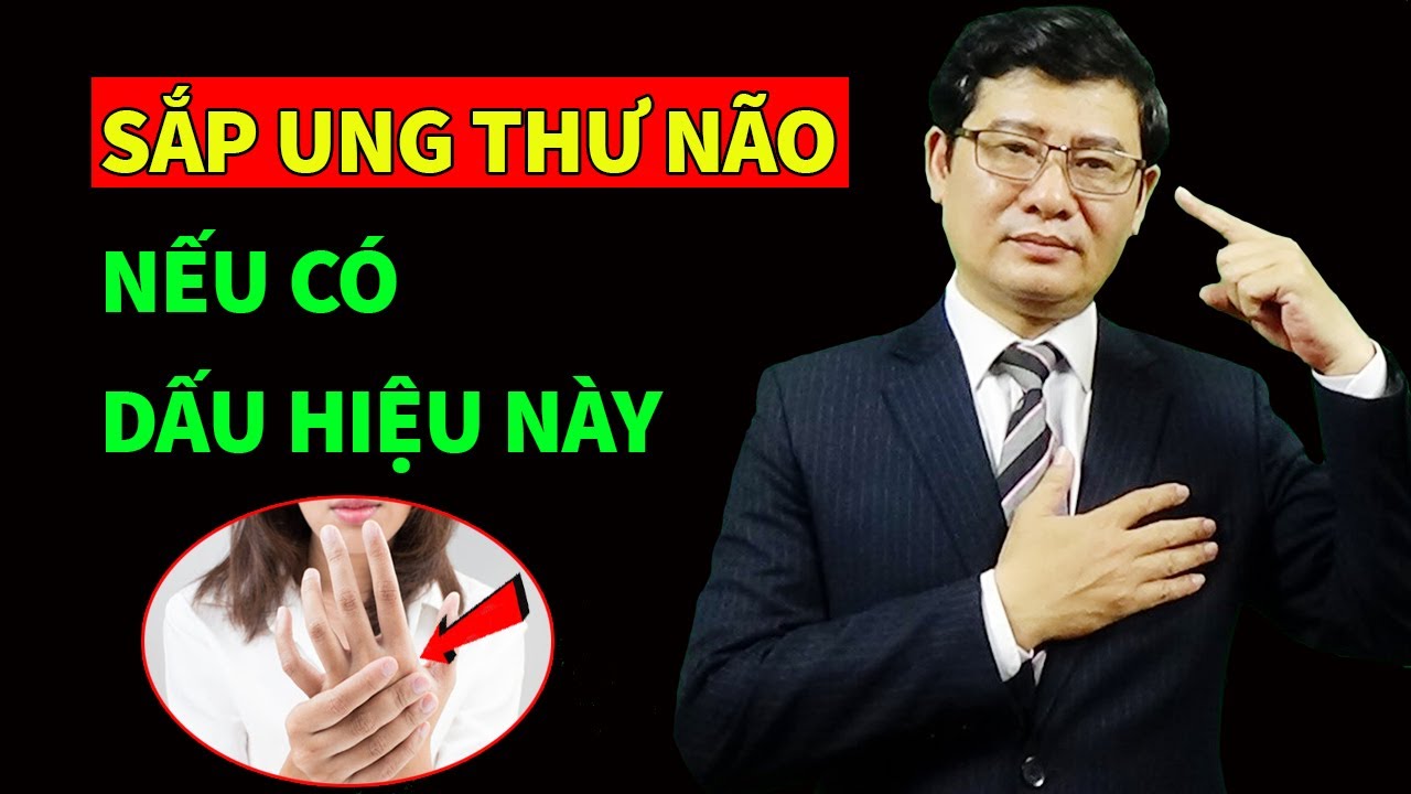 Sắp ung thư não nếu có 8 dấu hiệu này | Sống Khỏe Sống Tốt