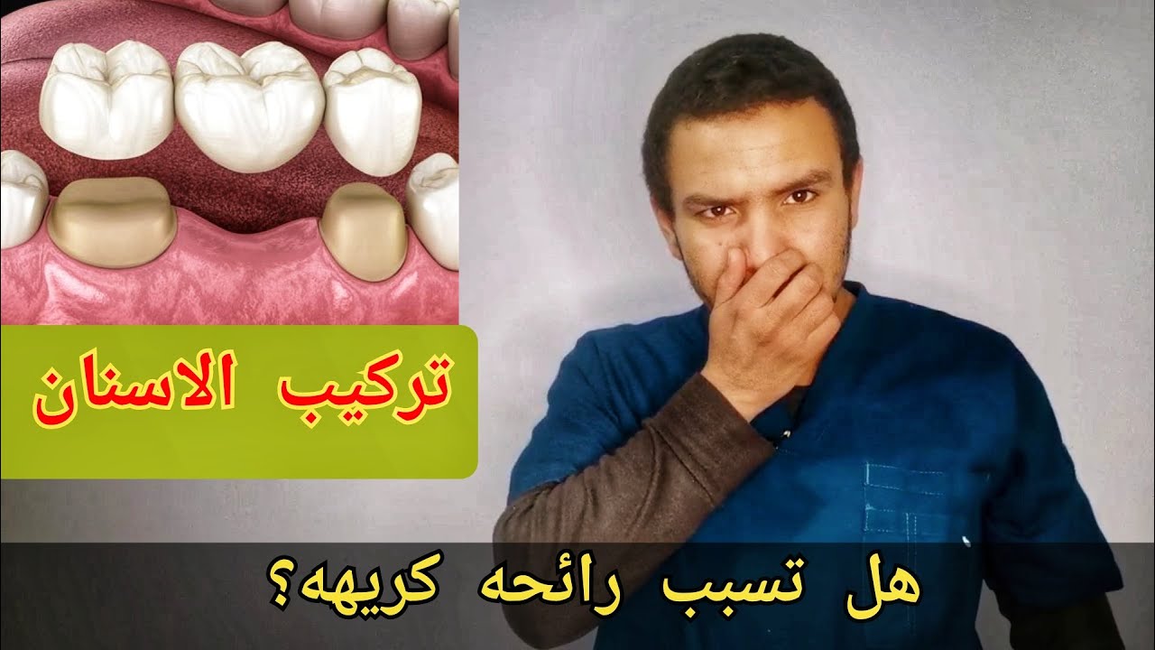 افضل نوع تركيب اسنان لا يسبب رائحه الفم الكريهة