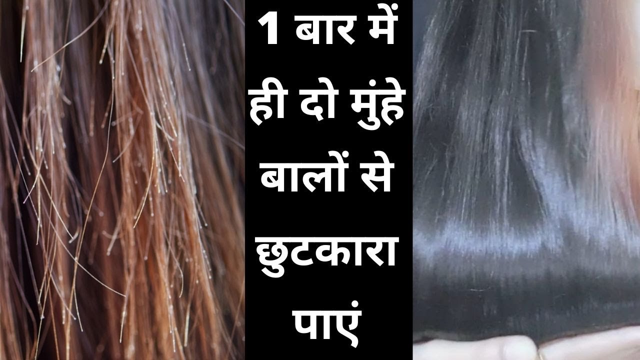 दो मुंहे बाल कैसे निकाले/how to remove split ends hair/दो मुंहे से तुरंत छुटकारा पाएं Hair care Tips