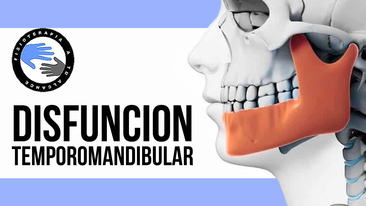 Dolor de mandibula o disfucion de la atm, que es, por que se produce, tratamiento