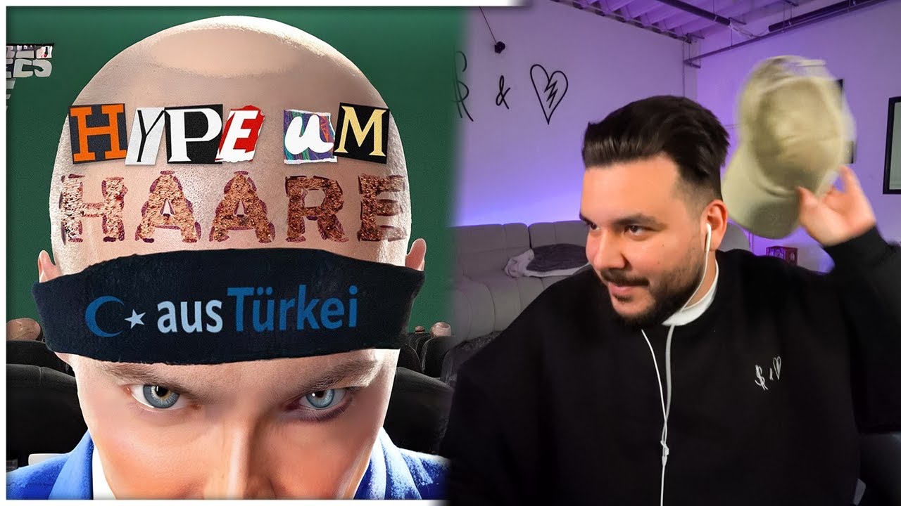 Glatze oder Haartransplantation? 🤔