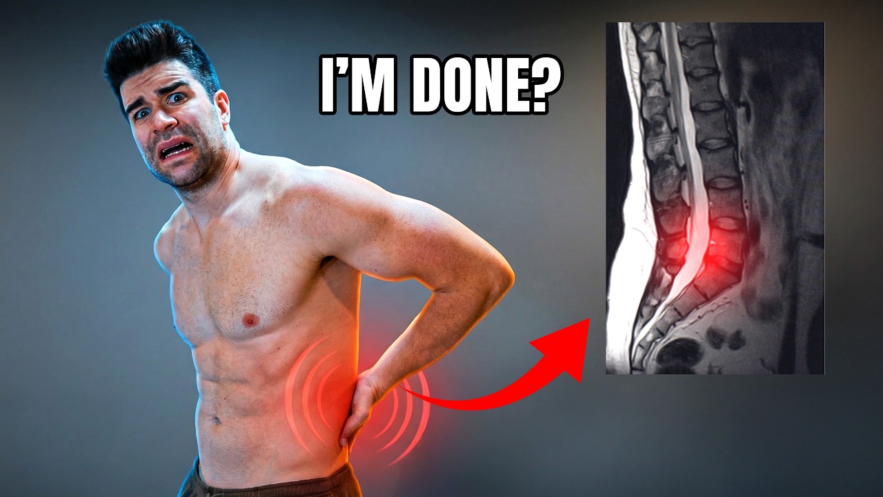 What Happened to My Back?
