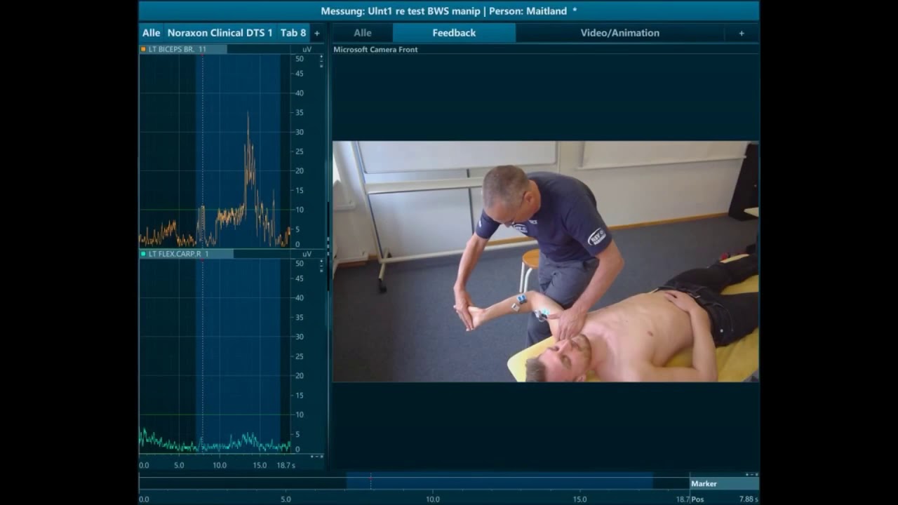 Manipulation, ULNT1 and EMG; Pieter Westerhuis; IMTA