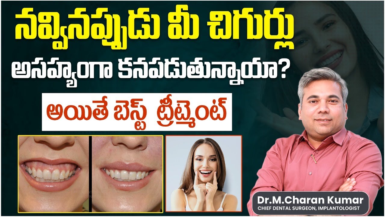Gummy Smile Correction In Telugu || Gummy Smile Causes || Gummy Smile Correction Without Surgery