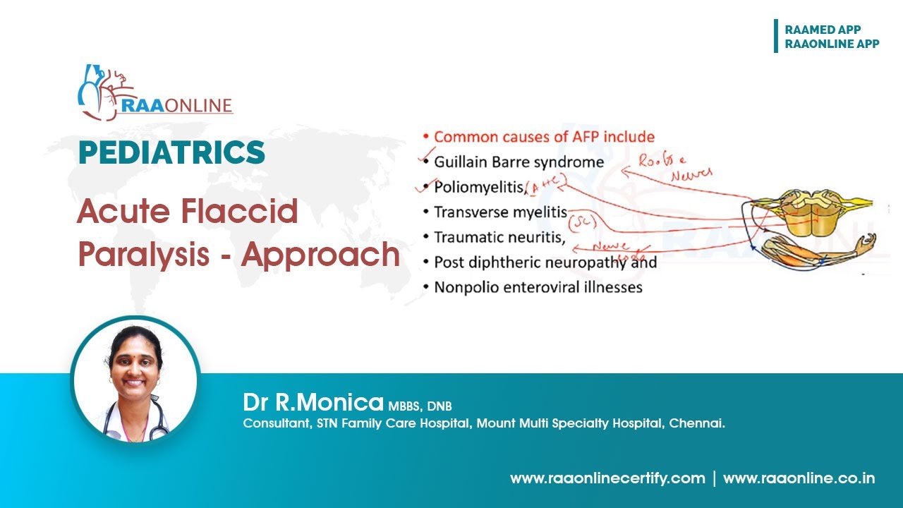 Pediatrics | Acute Flaccid Paralysis - Approach | Raaonline #pediatrics #acute #flaccid #paralysis