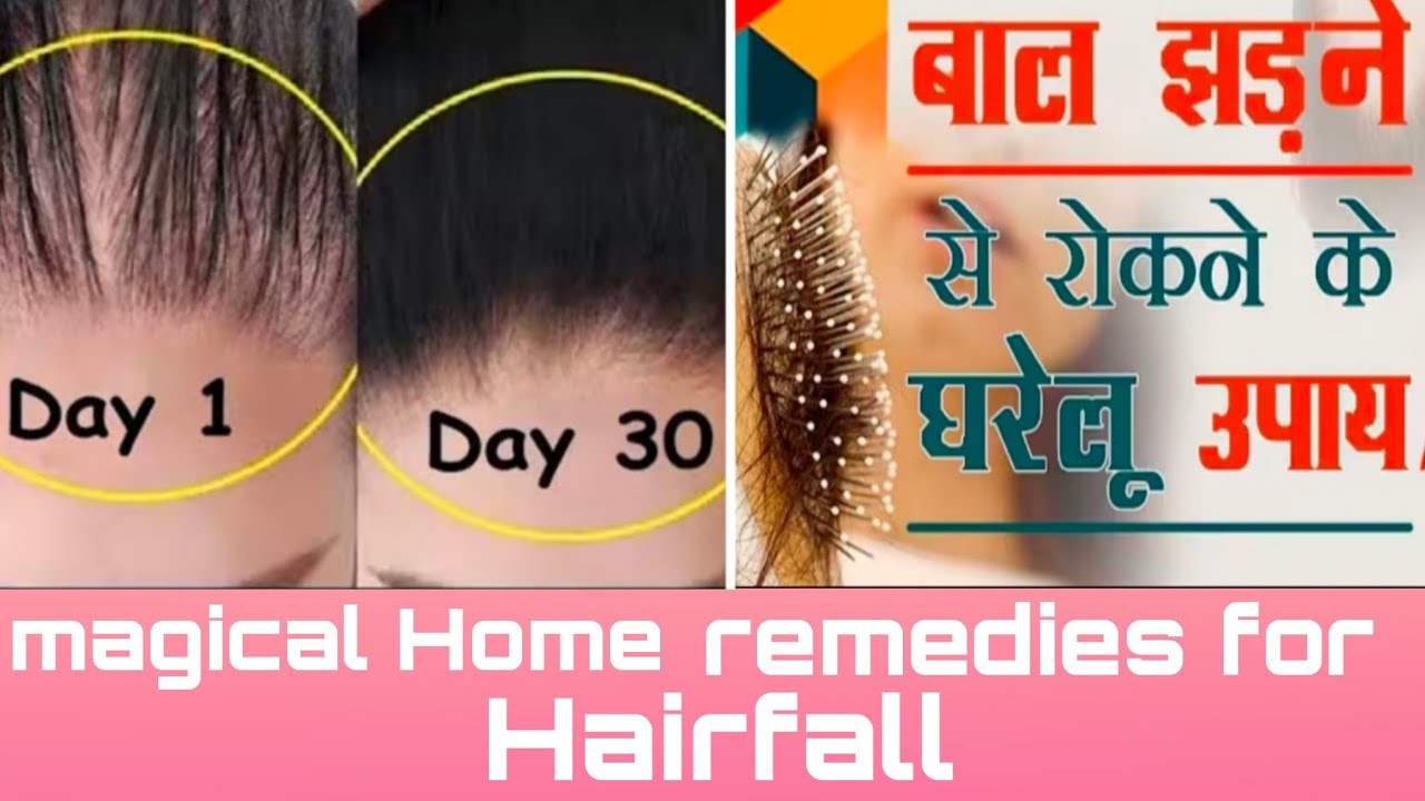 Baal ko tootne Jhadne Or Ganjapan Jad Se Roke Iss Gharelu Nuskhe Ko Lagakar|Hairfall Home Remedies