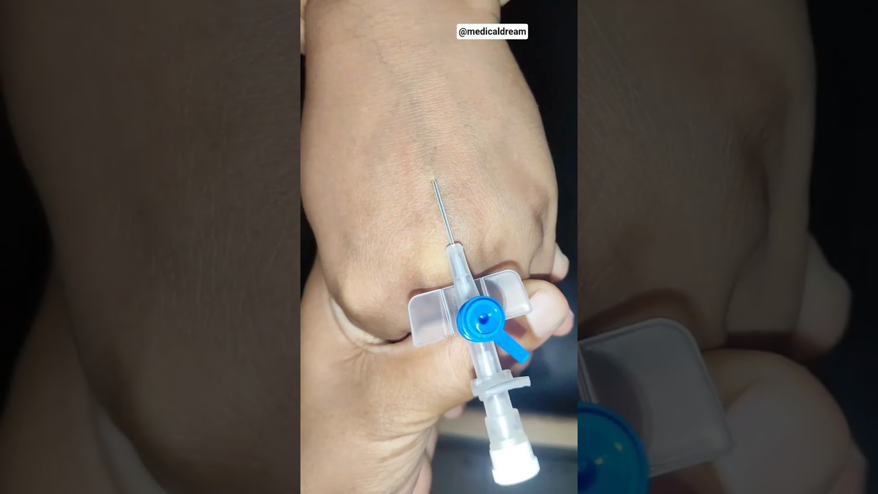How to Insert Blue Cannula (22G) Step by Step | Nursing Skills | IV Cannula Insertion #shorts