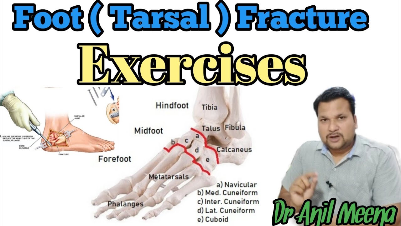 metatarsal bone fracture recovery exercises | metatarsal fracture exercises | metatarsal | in hindi