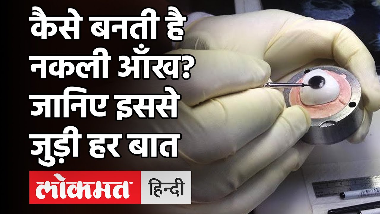 Artificial Eyes Cost |How Prosthetic Artificial Eyes and Ears  Made |नकली आँख कैसे बनती है ?