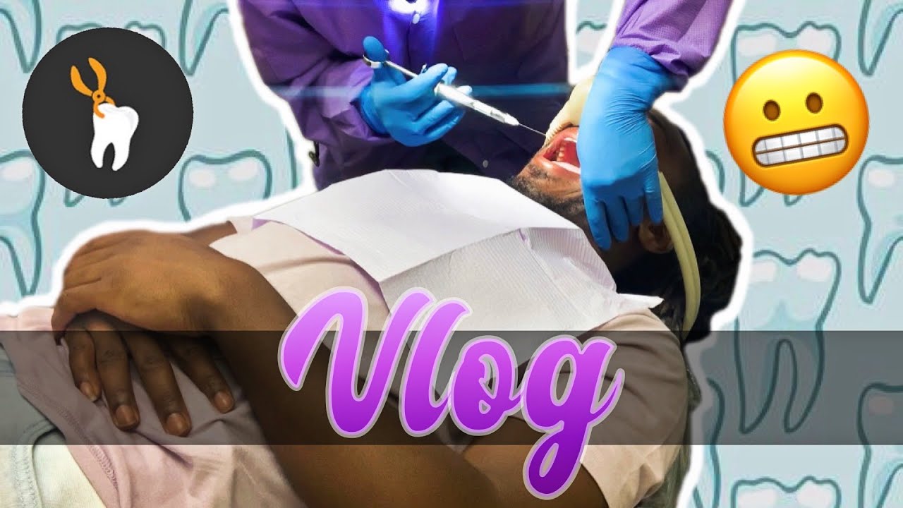 VLOG: I GOT MY WISDOM TOOTH REMOVED *FAIL*