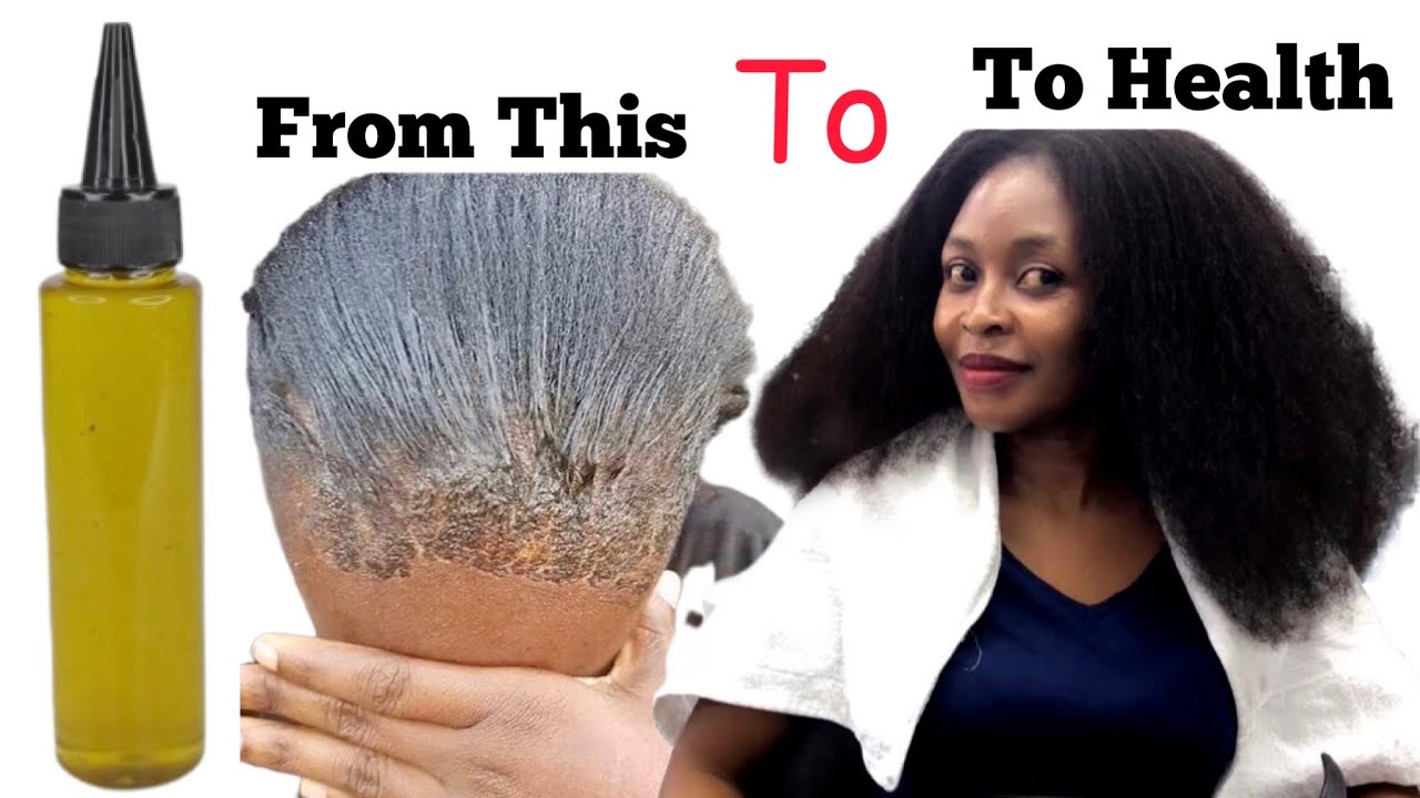 You will not Believe!! Long and Thick hair with this oil in just 2-3 weeks Proven and Effective