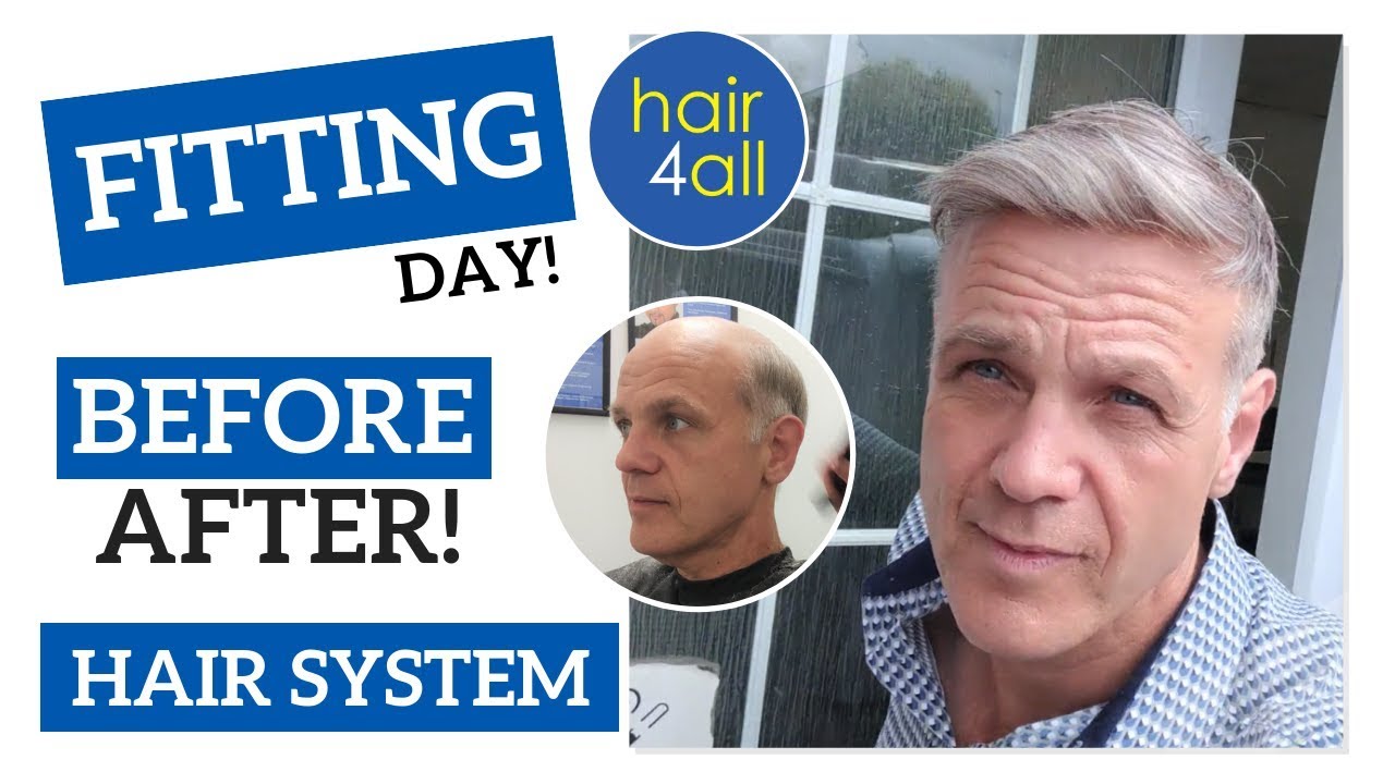 Before & After | Hair System | Non-Surgical Hair Replacement System for Men/Women UK/USA