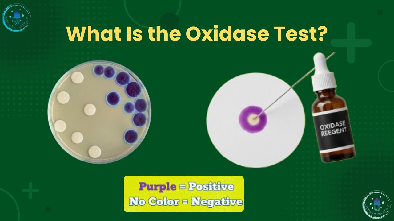 Oxidase Test for Bacteria | Principle, Procedure, Color Reaction & Results