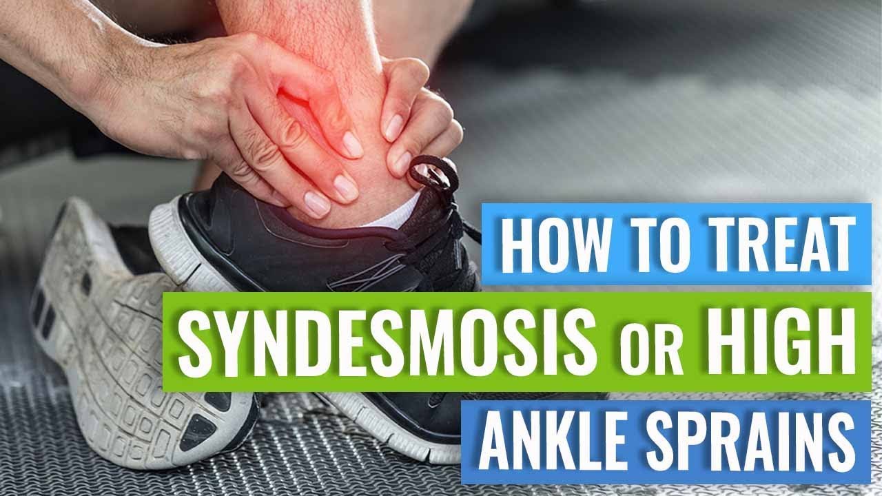 Syndesmosis or High Ankle Sprain Treatment