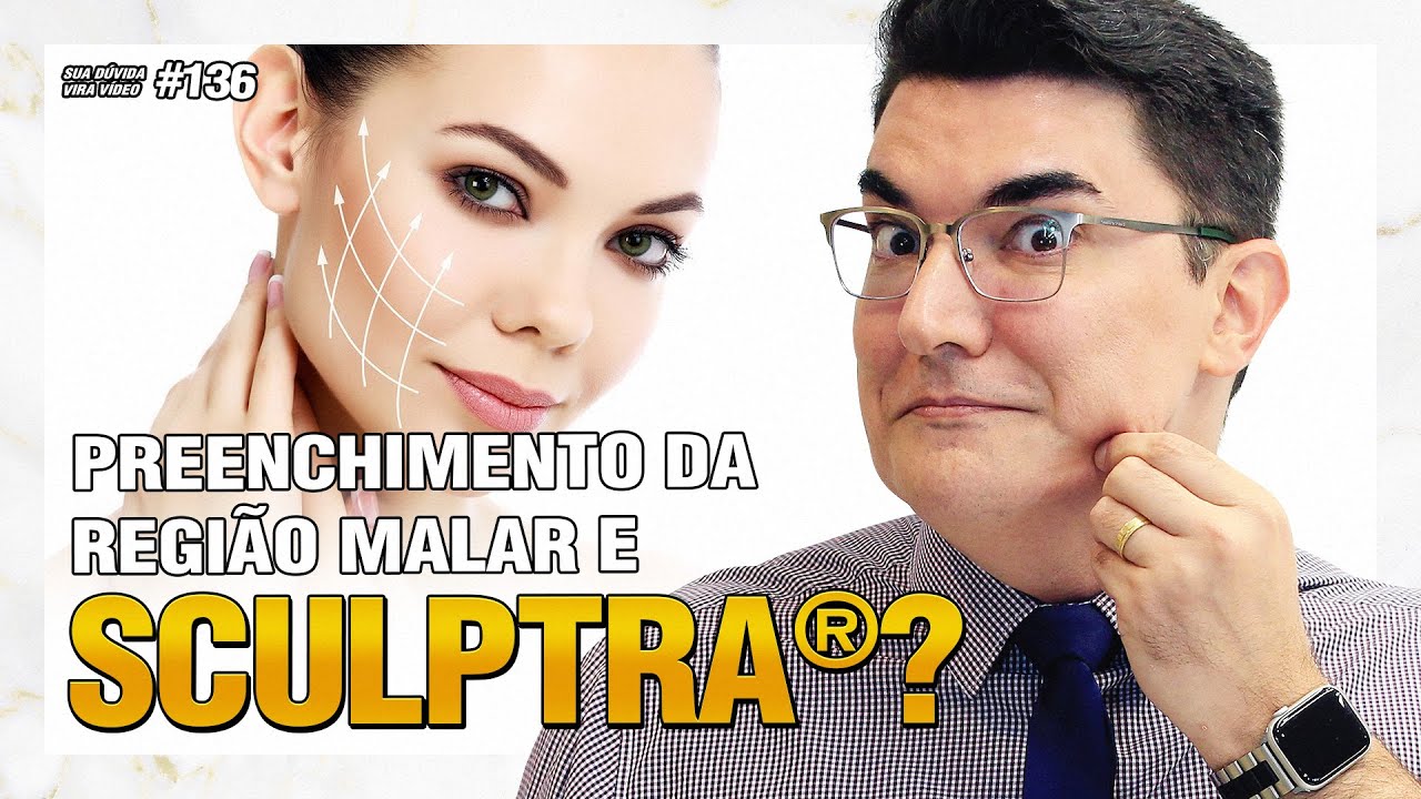 Preenchimento da Região Malar e SCULPTRA®? | Sua Dúvida Vira Vídeo #136