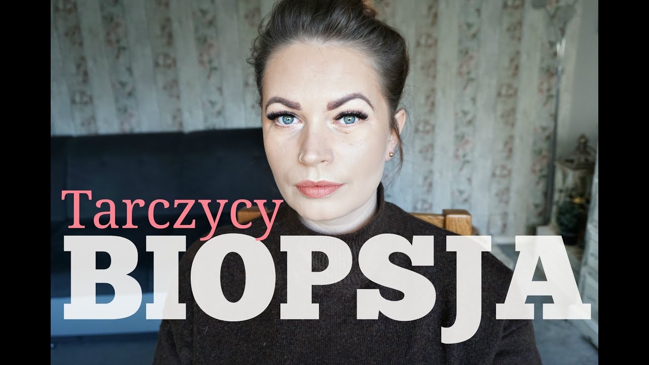 BIOPSJA TARCZYCY:JAK WYGLĄDA ZABIEG,CZY TO BOLI?ғoĸυѕowana