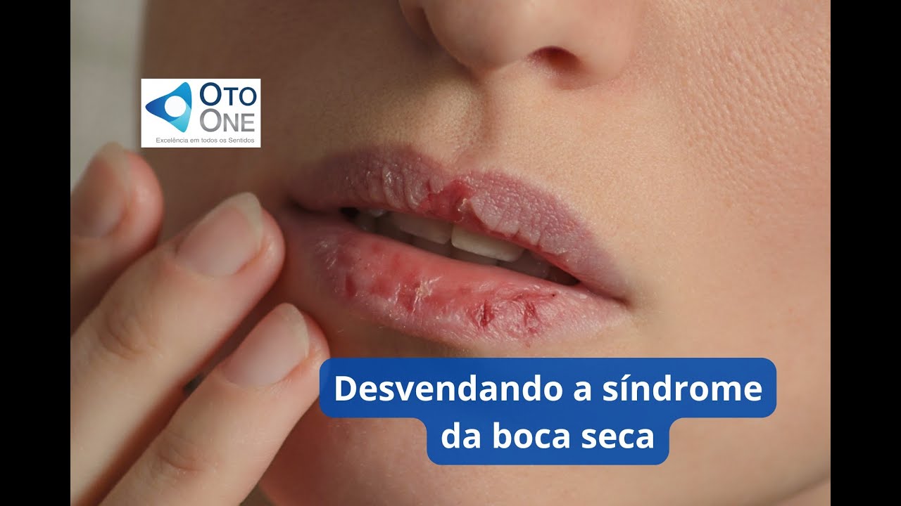 Síndrome da Boca Seca (Xerostomia) Perguntas e respostas com Dr. Bruno Rossini, otorrino