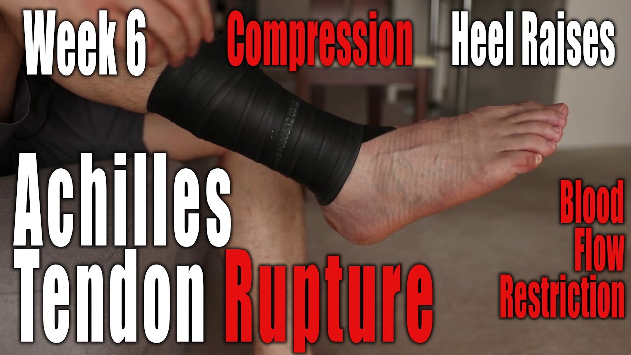 Achilles Tendon Rupture, Non-Surgical Recovery | Week 6: Compression, BFR, Heel Raises and More