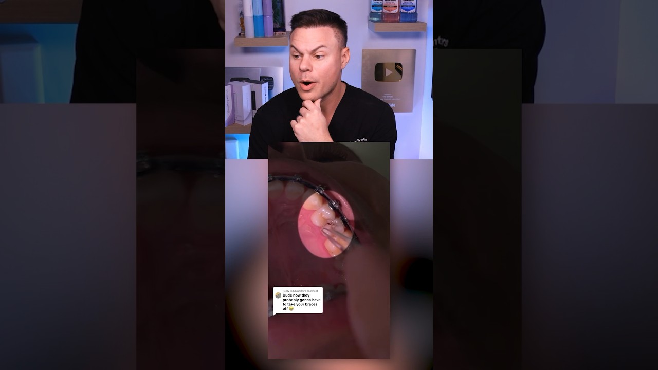 How Did He Brush Everyday And STILL Get Cavities?! 🦷🪥