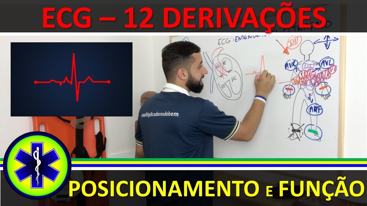INTRODUÇÃO AO ECG - POSICIONAMENTO E FUNÇÃO DAS 12 DERIVAÇÕES