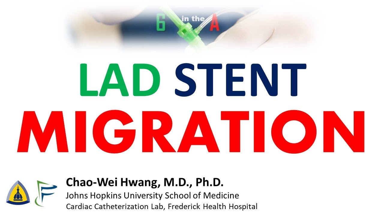 Stent Migration in the LAD