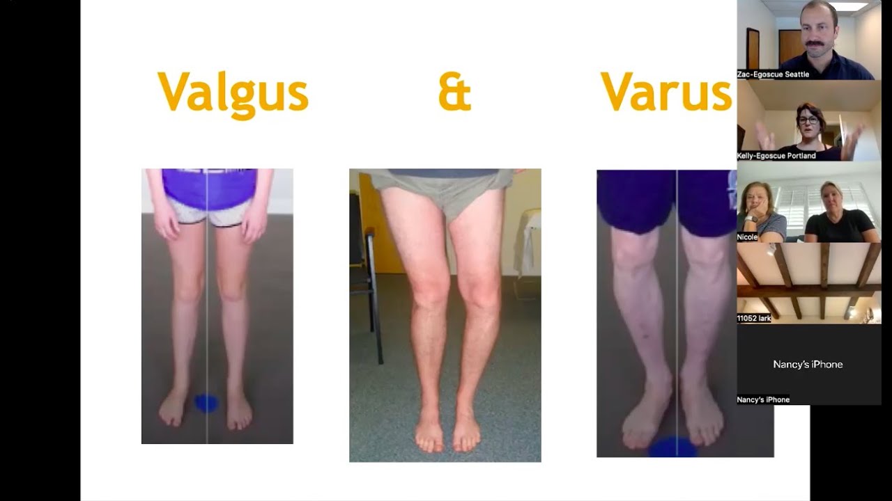 How to fix your knee pain with the Egoscue Method