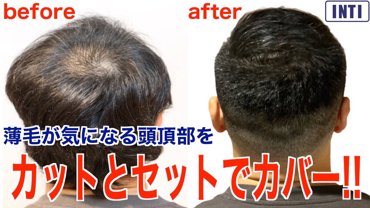 【薄毛】薄毛専門美容師が教える『薄毛が気になる頭頂部』をカットとセットでカバーする方法！！