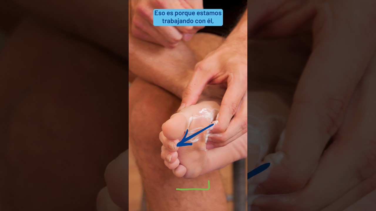 &iexcl;Descubre el Secreto! Juanetes: C&oacute;mo Quitarlos F&aacute;cilmente con Trucos y Remedios👣