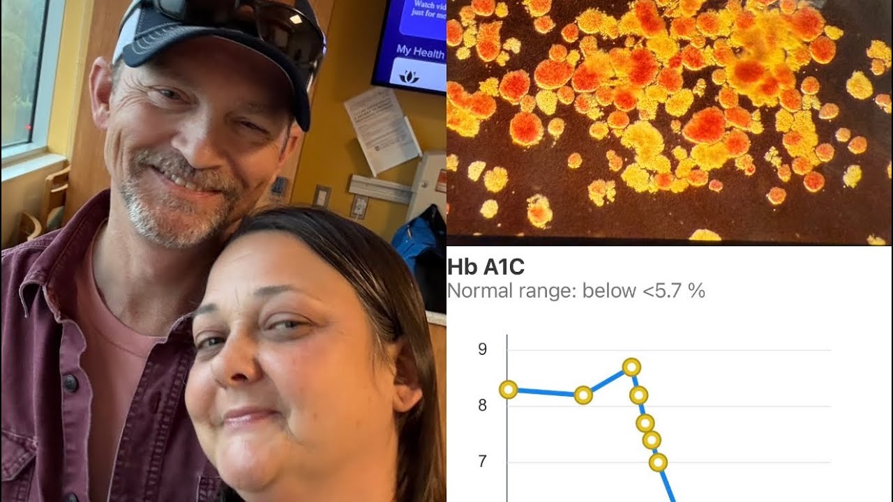 Eledon has cured another patient of Type 1 Diabetes!