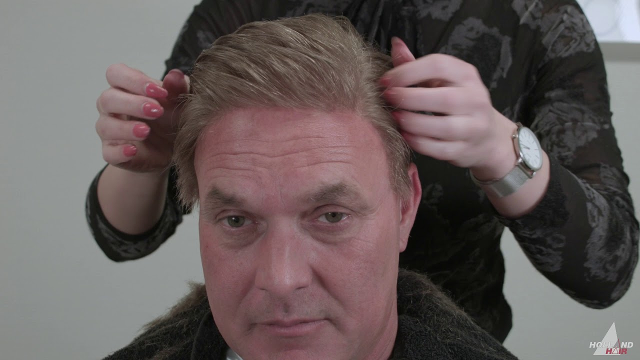 hairloss MacHair Amsterdam hairreplacement hairsolutions men alopecia totalis baldnes contactskin th