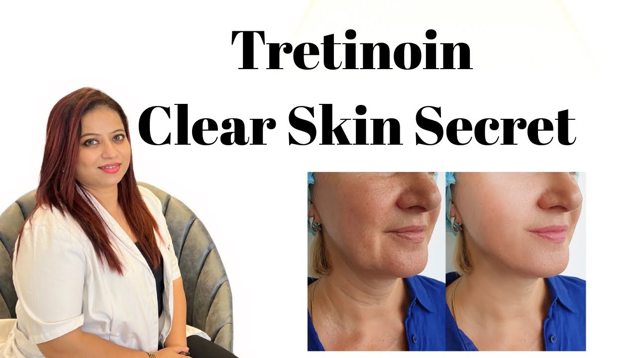 Tretinoin Cream for Beginners | How to Use, Benefits & Side Effects