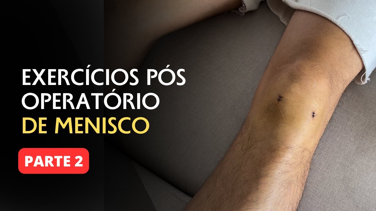 FISIOTERAPIA PARA CIRURGIA DE MENISCO - EXERCÍCIOS DE PÓS OPERATÓRIO [parte 2]