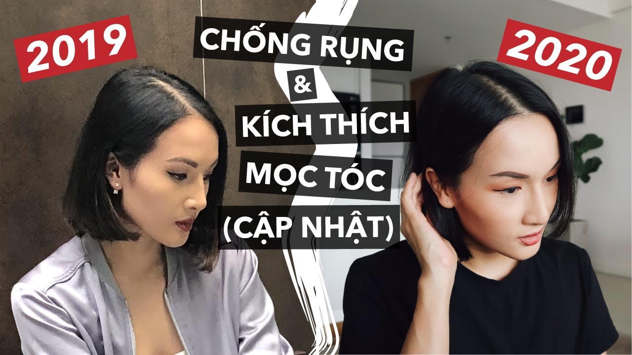 Cập nhật cách giảm rụng tóc & kích thích mọc tóc tuổi U30