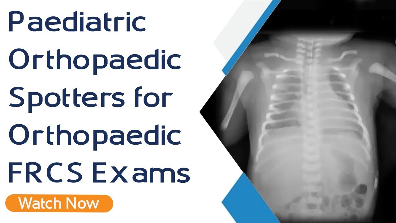 Paediatric Orthopaedic Spotters for Orthopaedic FRCS Exams | Orthopaedic Academy