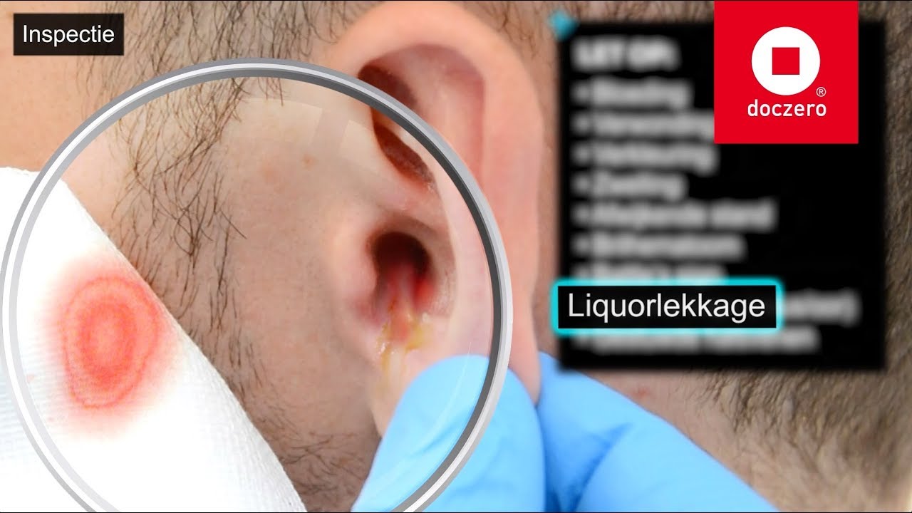 Lichamelijk onderzoek | Doczero E-learning