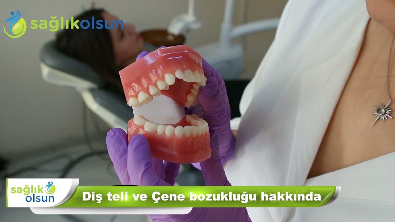 Diş teli ve çene bozukluğu hakkında