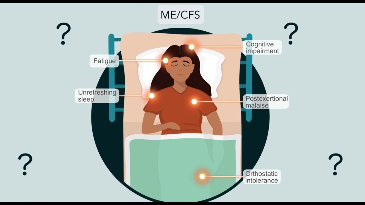 Is fatty acid oxidation altered in ME/CFS immune cell populations?