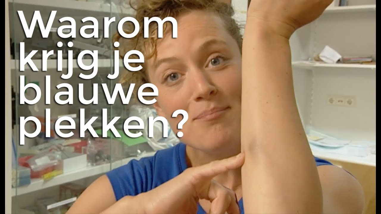 Waarom krijg je blauwe plekken? | Vragen van Kinderen