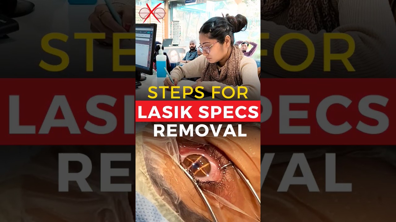 Steps For Lasik Specs Removal Surgery