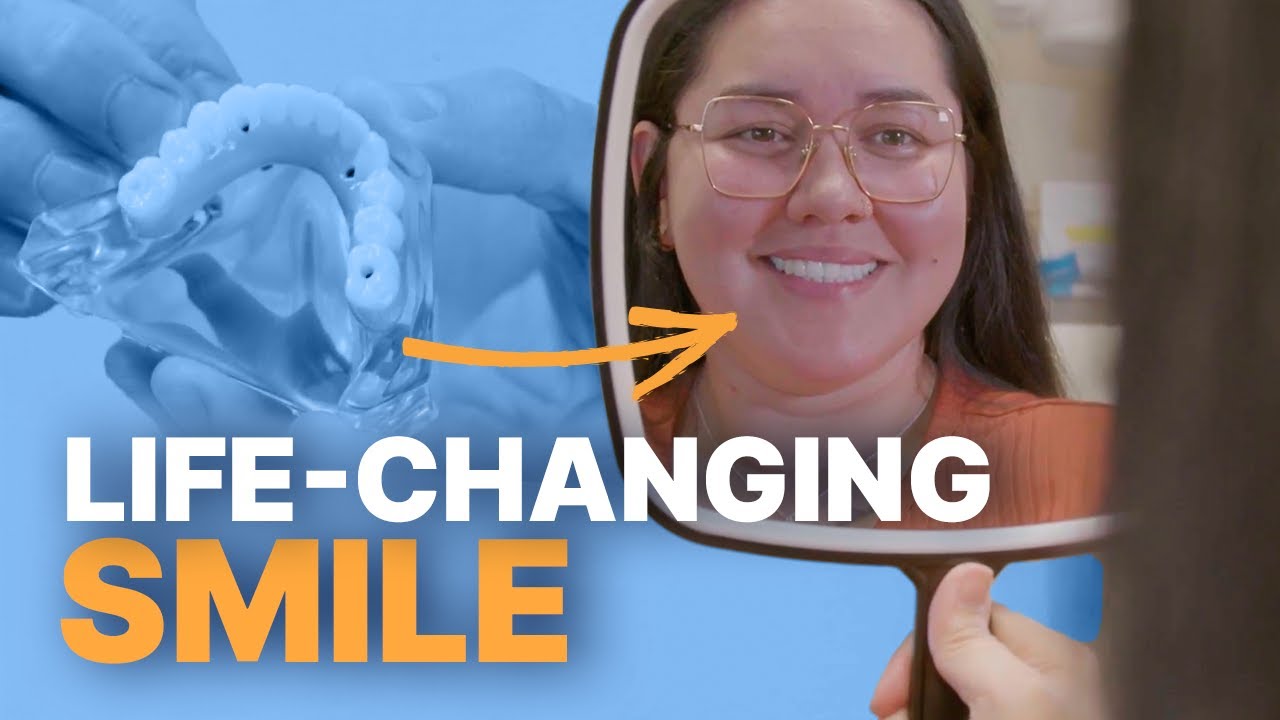 Permanent Teeth | A Life Changing Smile Solution