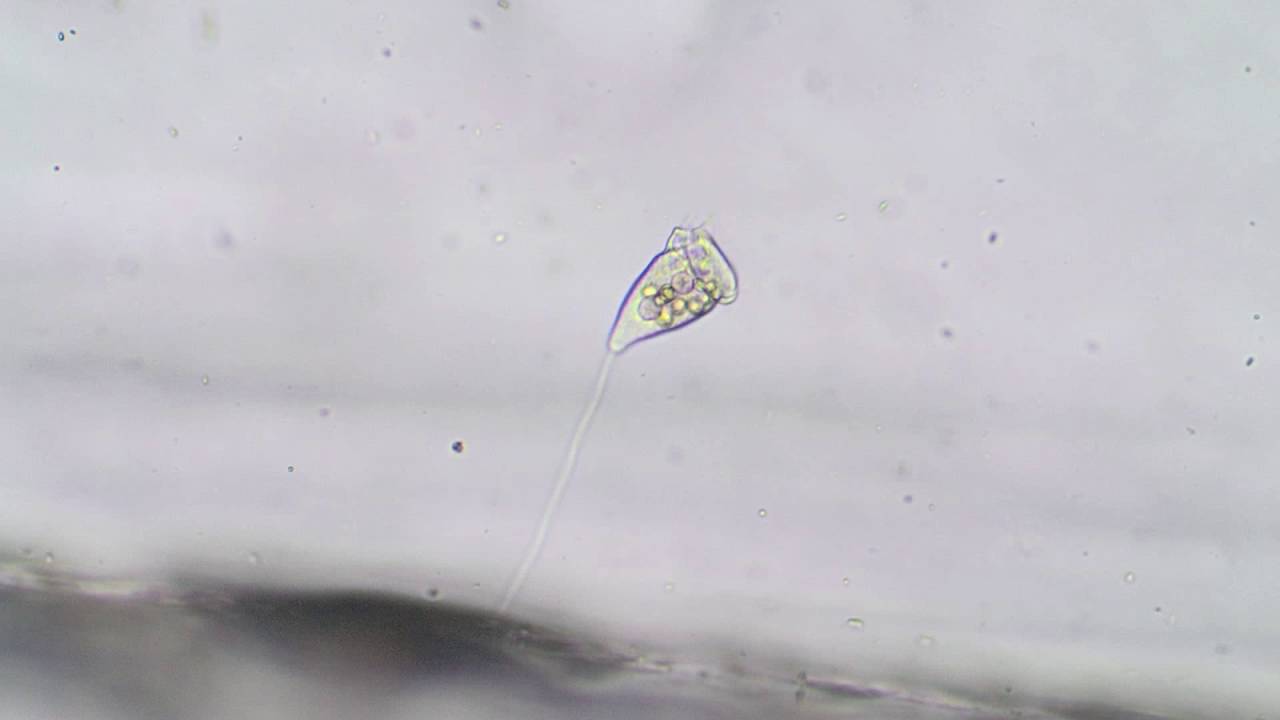 Vorticella - a ciliate