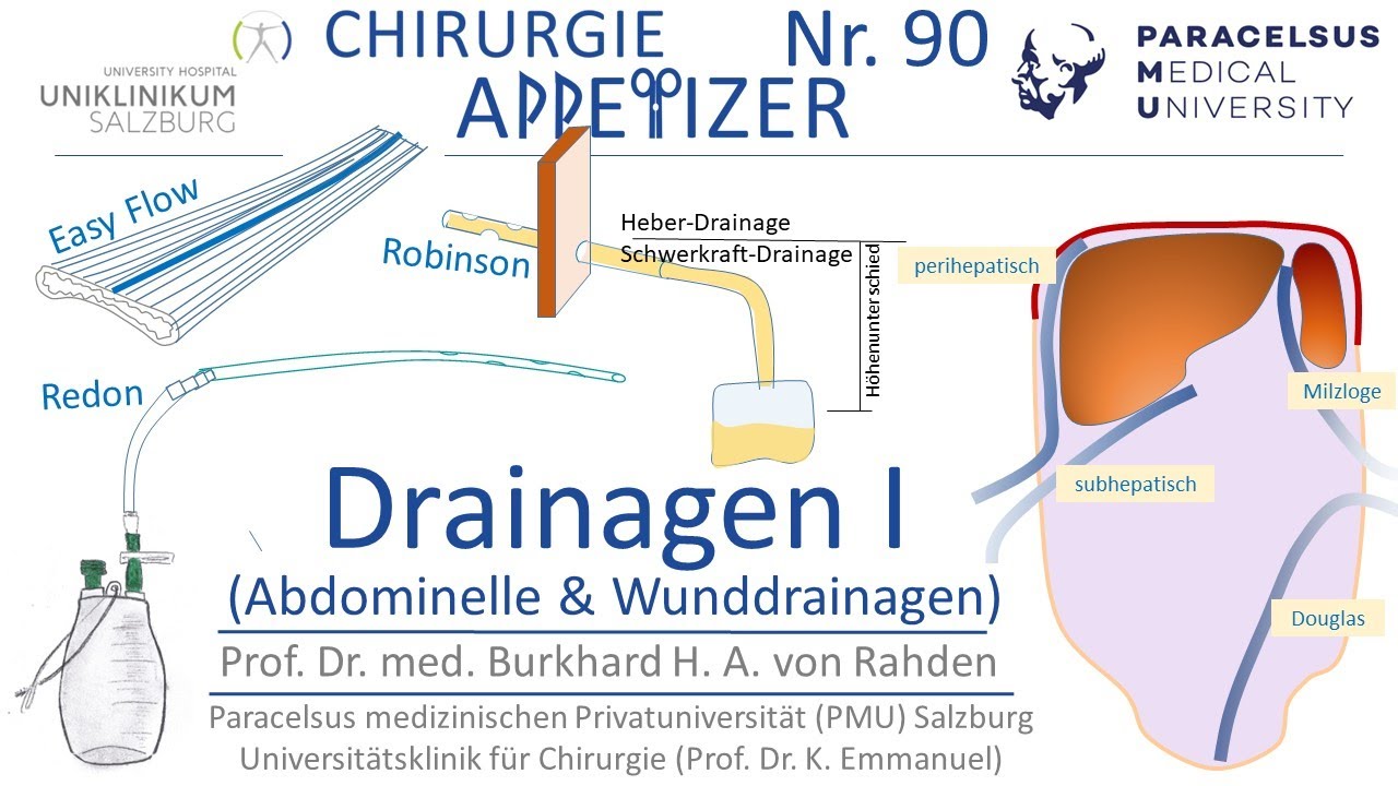 Drainagen I Abdominal- und Wunddrainagen CHIRURGIE APPetizer Nr. 90