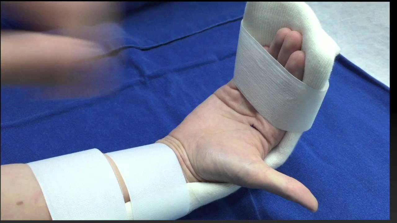 Rehabilitación de Lesiones de tendones flexores de los dedos